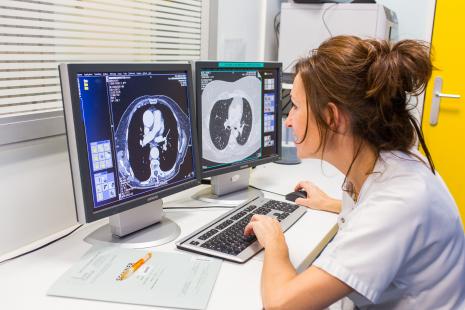 En Chine, un unique scanner thoracique est proposé à tous les adultes de 40 à 74 ans, asymptomatiques présentant un risque élevé de cancer du poumon